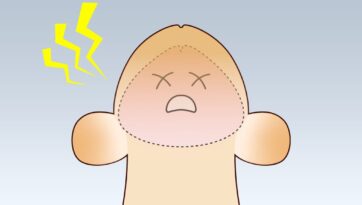繰り返す亀頭包皮炎はどうしたら治る？原因や治療方法について医師が解説！