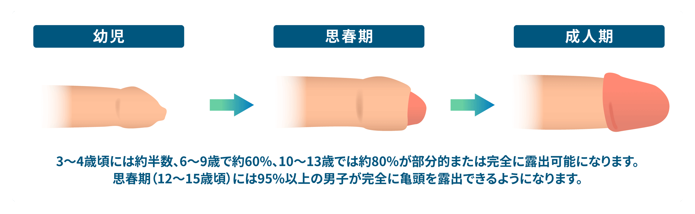 男の子の包皮は何歳で剥けるのが正常ですか？