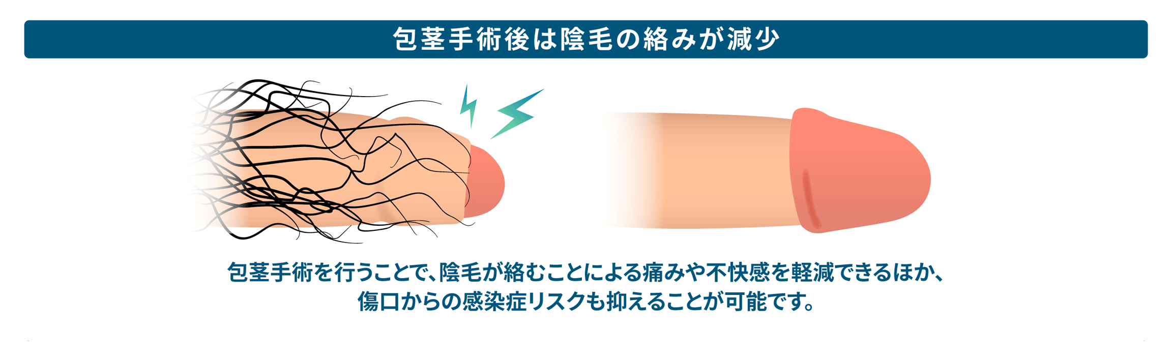 感染症リスクが減少する